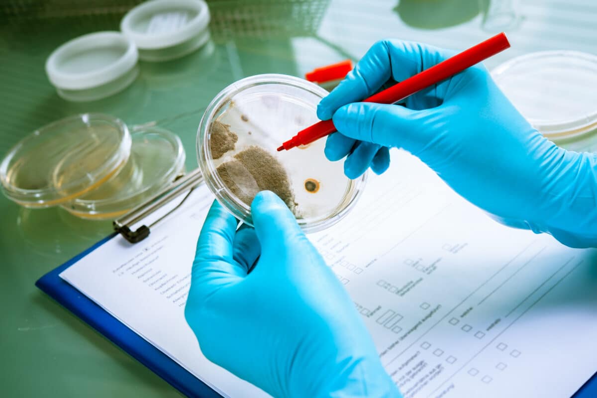 Listeriosis Contamination of NonDairy Silk Products Sold in Canada