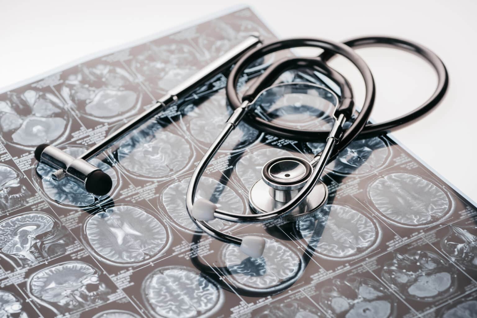 Listeria monocytogenes is a Particularly Deadly food-borne Pathogen Due to Its Ability to Bypass the Blood-Brain Barrier