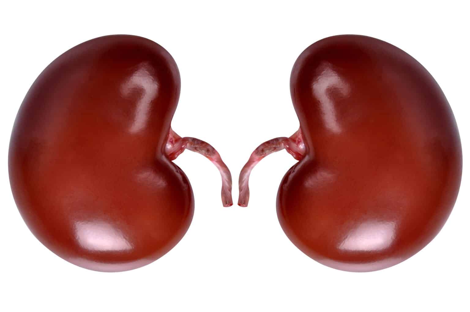 Hemolytic Uremic Syndrome (HUS): Causes, Risk Factors, and Clinical Significance