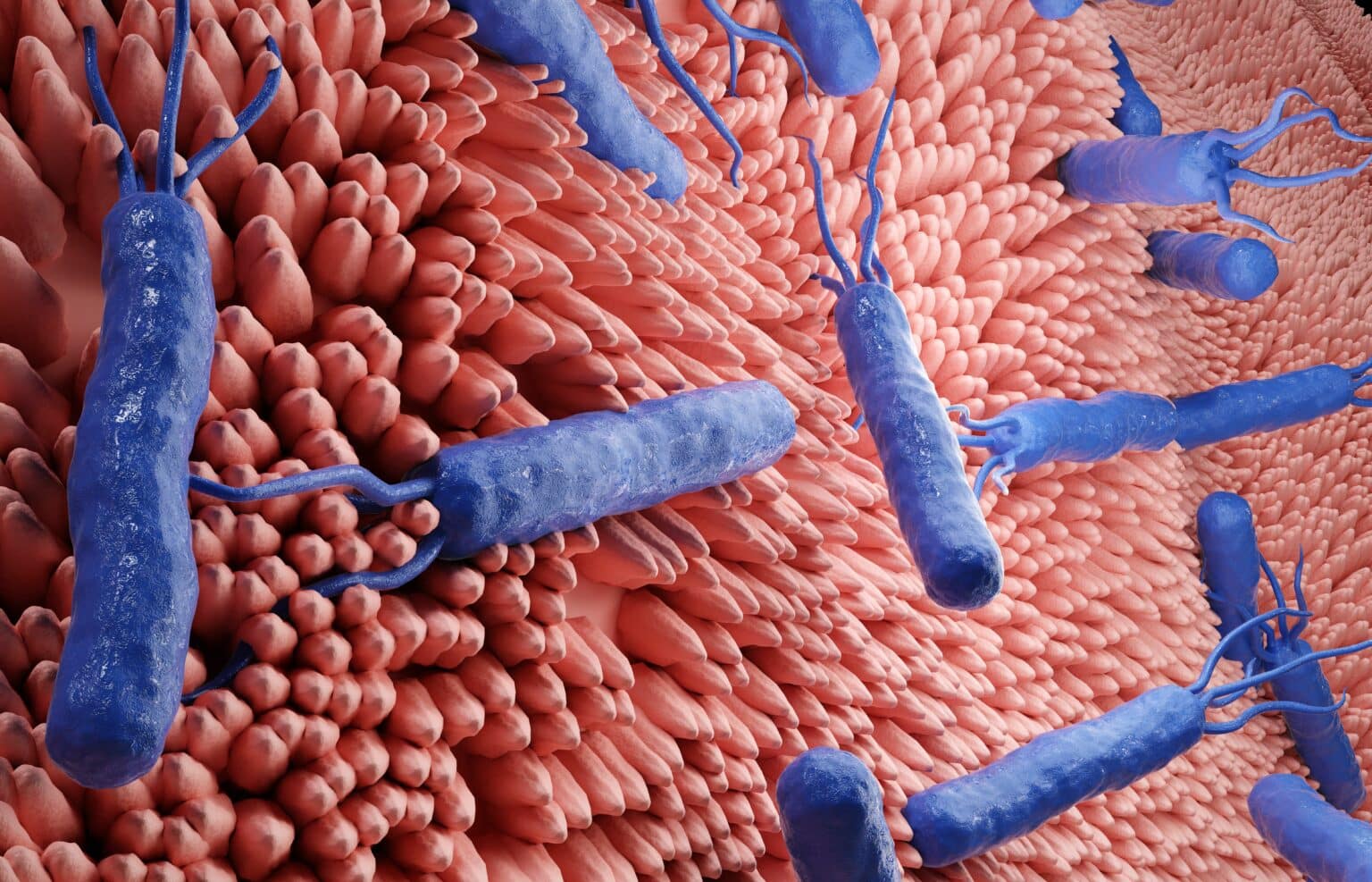 The Summer Surge of Cyclospora: Why Health Officials Are Still Searching for the Source The Summer Surge of Cyclospora: Why Health Officials Are Still Searching for the Source