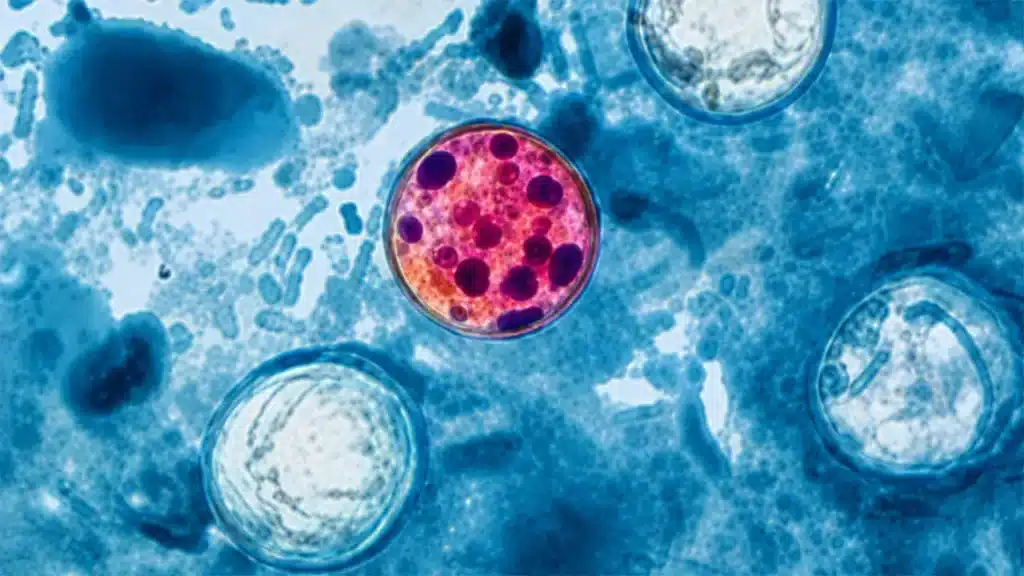 Cyclospora Rising Update: U.S. Outbreak Grows as Investigators Zero In on Leafy Greens